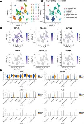 Disulfidptosis-related signature elucidates the prognostic, immunologic, and therapeutic characteristics in ovarian cancer